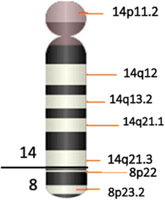 A maternally derived complex small supernumerary marker chromosome involving chromosomes 8 and 14: case report and review of the literature